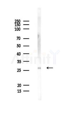 DKKL1 Antibody - Western blot analysis of lysates from Rat spleen, using DKKL1 Antibody at 1/1000 dilution.