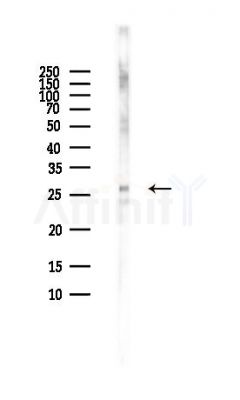 DKK4 Antibody - Western blot analysis of lysates from HUVEC cells(LPS,4h treatment), using DKK4 Antibody at 1/1000 dilution.