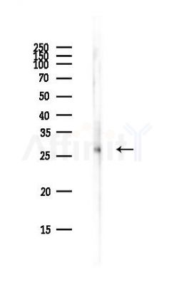DKK4 Antibody - Western blot analysis of lysates from EC304 cells(LPS,4h treatment), using DKK4 Antibody at 1/1000 dilution.