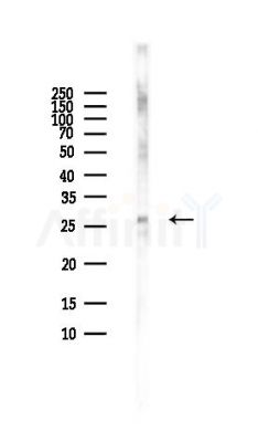 DKK4 Antibody - Western blot analysis of lysates from HUVEC cells(LPS,4h treatment), using DKK4 Antibody at 1/1000 dilution.