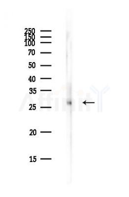 DKK4 Antibody - Western blot analysis of lysates from EC304 cells(LPS,4h treatment), using DKK4 Antibody at 1/1000 dilution.