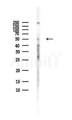 MGAT1 Antibody - Western blot analysis of lysates from HUVEC cells(LPS,4h treatment), using MGAT1 Antibody at 1/1000 dilution.