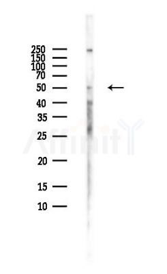 MGAT1 Antibody - Western blot analysis of lysates from HUVEC cells(LPS,4h treatment), using MGAT1 Antibody at 1/1000 dilution.