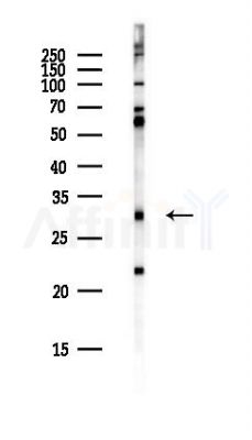 SPIB Antibody - Western blot analysis of lysates from PC12 cells(heat-shock,45min treatment), using SPIB Antibody at 1/1000 dilution.