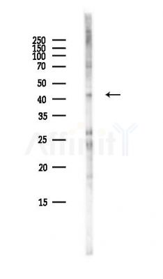 FANCF Antibody - Western blot analysis of lysates from Hela cells(heat-shock,45min treatment), using FANCF Antibody at 1/1000 dilution.
