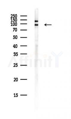 CHAMP1 Antibody - Western blot analysis of lysates from PC12 cells(heat-shock,45min treatment), using CHAMP1 Antibody at 1/1000 dilution.