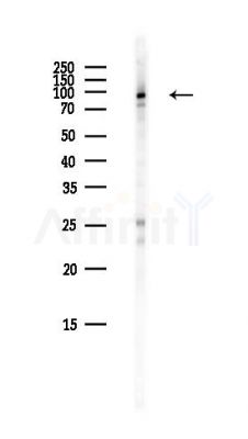 CHAMP1 Antibody - Western blot analysis of lysates from Hela cells(heat-shock,45min treatment), using CHAMP1 Antibody at 1/1000 dilution.