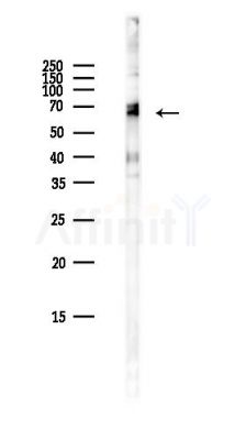 KLHL26 Antibody - Western blot analysis of lysates from Hela cells(heat-shock,45min treatment), using KLHL26 Antibody at 1/1000 dilution.