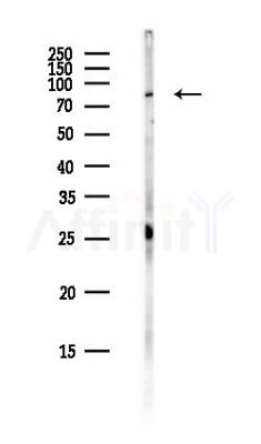 MLLT1 Antibody - Western blot analysis of lysates from PC12 cells(heat-shock,45min treatment), using MLLT1 Antibody at 1/1000 dilution.