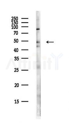 FEZF2 Antibody - Western blot analysis of lysates from PC12 cells(heat-shock,45min treatment), using FEZF2 Antibody at 1/1000 dilution.