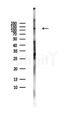 ADAMTS6 Antibody - Western blot analysis of lysates from HUVEC cells(LPS,4h treatment), using ADAMTS6 Antibody at 1/1000 dilution.