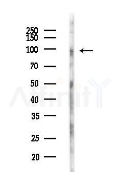 DIS3L2 Antibody - Western blot analysis of lysates from LoVo cells(heat-shock,45min treatment), using DIS3L2 Antibody at 1/1000 dilution.