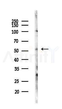 CPSF7 Antibody - Western blot analysis of lysates from LoVo cells(heat-shock,45min treatment), using CPSF7 Antibody at 1/1000 dilution.