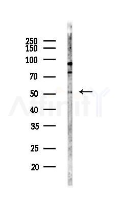 CPSF7 Antibody - Western blot analysis of lysates from Hela cells(LPS,4h treatment), using CPSF7 Antibody at 1/1000 dilution.