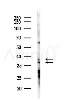 RHAG Antibody - Western blot analysis of lysates from LoVo cells(heat-shock,45min treatment), using RHAG Antibody at 1/1000 dilution.