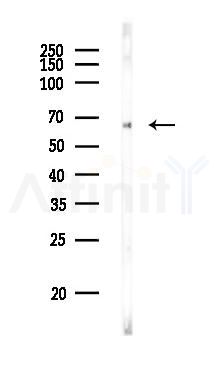 SLC13A3 Antibody - Western blot analysis of lysates from PC12 cells, using SLC13A3 Antibody at 1/1000 dilution.