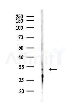 SLC25A45 Antibody - Western blot analysis of lysates from LoVo cells(heat-shock,45min treatment), using SLC25A45 Antibody at 1/1000 dilution.