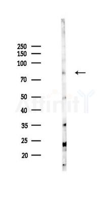 SLC7A14 Antibody - Western blot analysis of lysates from HepG2 cells(starvation,24h treatment), using SLC7A14 Antibody at 1/1000 dilution.
