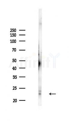 PTPMT1 Antibody - Western blot analysis of lysates from Mouse liver, using PTPMT1 Antibody at 1/1000 dilution.