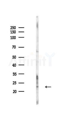 PTPMT1 Antibody - Western blot analysis of lysates from HepG2 cells(starvation,24h treatment), using PTPMT1 Antibody at 1/1000 dilution.