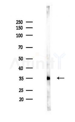 SLC25A32 Antibody - Western blot analysis of lysates from PC12 cells(UV,30min treatment), using SLC25A32 Antibody at 1/1000 dilution.