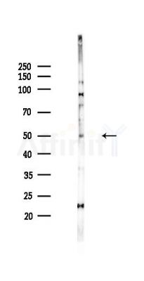 SLC46A3 Antibody - Western blot analysis of lysates from HepG2 cells(starvation,24h treatment), using SLC46A3 Antibody at 1/1000 dilution.