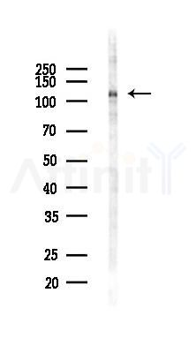 OAS3 Antibody - Western blot analysis of lysates from LoVo cells(heat-shock,45min treatment), using OAS3 Antibody at 1/1000 dilution.