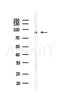 RANBP9 Antibody - Western blot analysis of lysates from LoVo cells(heat-shock,45min treatment), using RANBP9 Antibody at 1/1000 dilution.