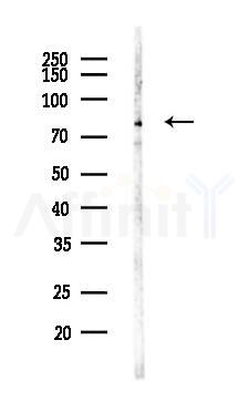 RANBP9 Antibody - Western blot analysis of lysates from Hela cells(LPS,4h treatment), using RANBP9 Antibody at 1/1000 dilution.