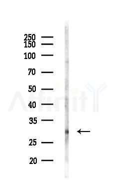 NANOS1 Antibody - Western blot analysis of lysates from LoVo cells(heat-shock,45min treatment), using NANOS1 Antibody at 1/1000 dilution.
