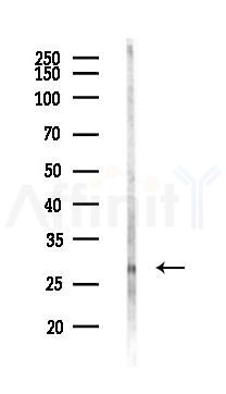 DUT Antibody - Western blot analysis of lysates from LoVo cells(heat-shock,45min treatment), using DUT Antibody at 1/1000 dilution.