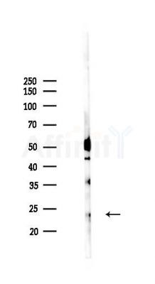 HMGB4 Antibody - Western blot analysis of lysates from Rat brain, using HMGB4 Antibody at 1/1000 dilution.