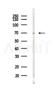 SP110 Antibody - Western blot analysis of lysates from LoVo cells(heat-shock,45min treatment), using SP110 Antibody at 1/1000 dilution.