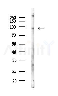 SLITRK6 Antibody - Western blot analysis of lysates from LoVo cells(heat-shock,45min treatment), using SLITRK6 Antibody at 1/1000 dilution.