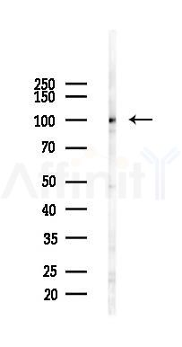 MGAT5 Antibody - Western blot analysis of lysates from Mouse testis, using MGAT5 Antibody at 1/1000 dilution.
