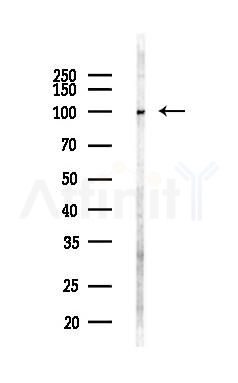 MGAT5 Antibody - Western blot analysis of lysates from LoVo cells(heat-shock,45min treatment), using MGAT5 Antibody at 1/1000 dilution.