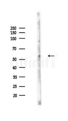 SLC17A5 Antibody - Western blot analysis of lysates from HepG2 cells(starvation,24h treatment), using SLC17A5 Antibody at 1/1000 dilution.