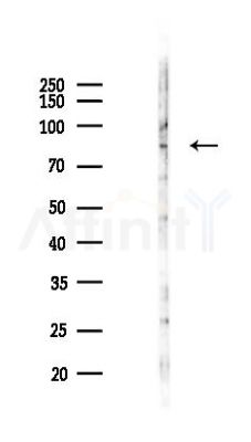 SNPH Antibody - Western blot analysis of lysates from Hela cells(LPS,4h treatment), using SNPH Antibody at 1/1000 dilution.