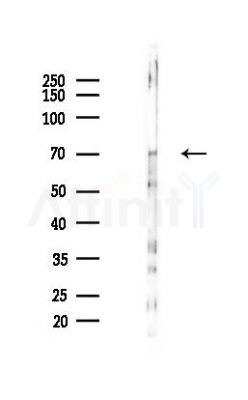 CALCOCO1 Antibody - Western blot analysis of lysates from Hela cells(LPS,4h treatment), using CALCOCO1 Antibody at 1/1000 dilution.