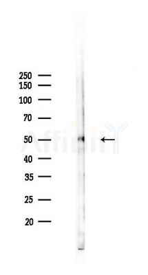 TRDMT1 Antibody - Western blot analysis of lysates from Rat brain, using TRDMT1 Antibody at 1/1000 dilution.
