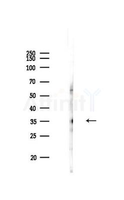 ART1 Antibody - Western blot analysis of lysates from PC12 cells, using ART1 Antibody at 1/1000 dilution.