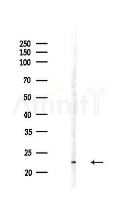 SRI Antibody - Western blot analysis of lysates from COLO205 cells(LPS,4h treatment), using SRI Antibody at 1/1000 dilution.