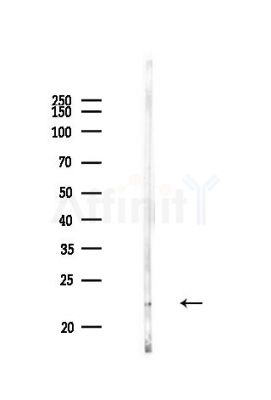 SRI Antibody - Western blot analysis of lysates from PC12 cells, using SRI Antibody at 1/1000 dilution.