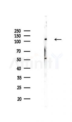 DDX46 Antibody - Western blot analysis of lysates from PC12 cells, using DDX46 Antibody at 1/1000 dilution.