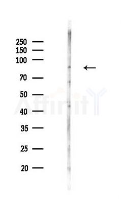 NAGLU Antibody - Western blot analysis of lysates from COLO205 cells(LPS,4h treatment), using NAGLU Antibody at 1/1000 dilution.