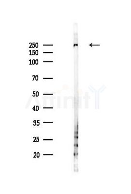 TRIP11 Antibody - Western blot analysis of lysates from Mouse liver, using TRIP11 Antibody at 1/1000 dilution.