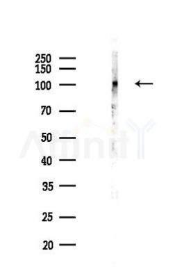 RBM25 Antibody - Western blot analysis of lysates from Hela cells(LPS,4h treatment), using RBM25 Antibody at 1/1000 dilution.