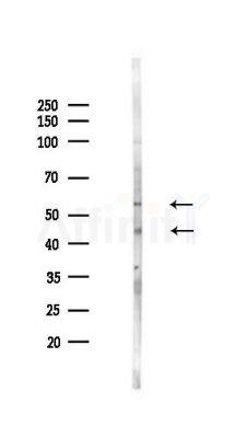 RNF128 Antibody - Western blot analysis of lysates from HepG2 cells(starvation,24h treatment), using RNF128 Antibody at 1/1000 dilution.