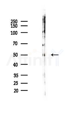 SLC38A5 Antibody - Western blot analysis of lysates from Hela cells(LPS,4h treatment), using SLC38A5 Antibody at 1/1000 dilution.