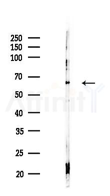 GTF3C5 Antibody - Western blot analysis of lysates from COLO205 cells(LPS,4h treatment), using GTF3C5 Antibody at 1/1000 dilution.